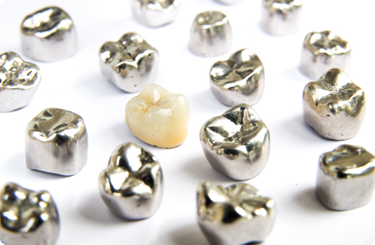 銀歯にはさまざまなデメリットがあります